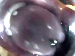 Mouthcam Trouble